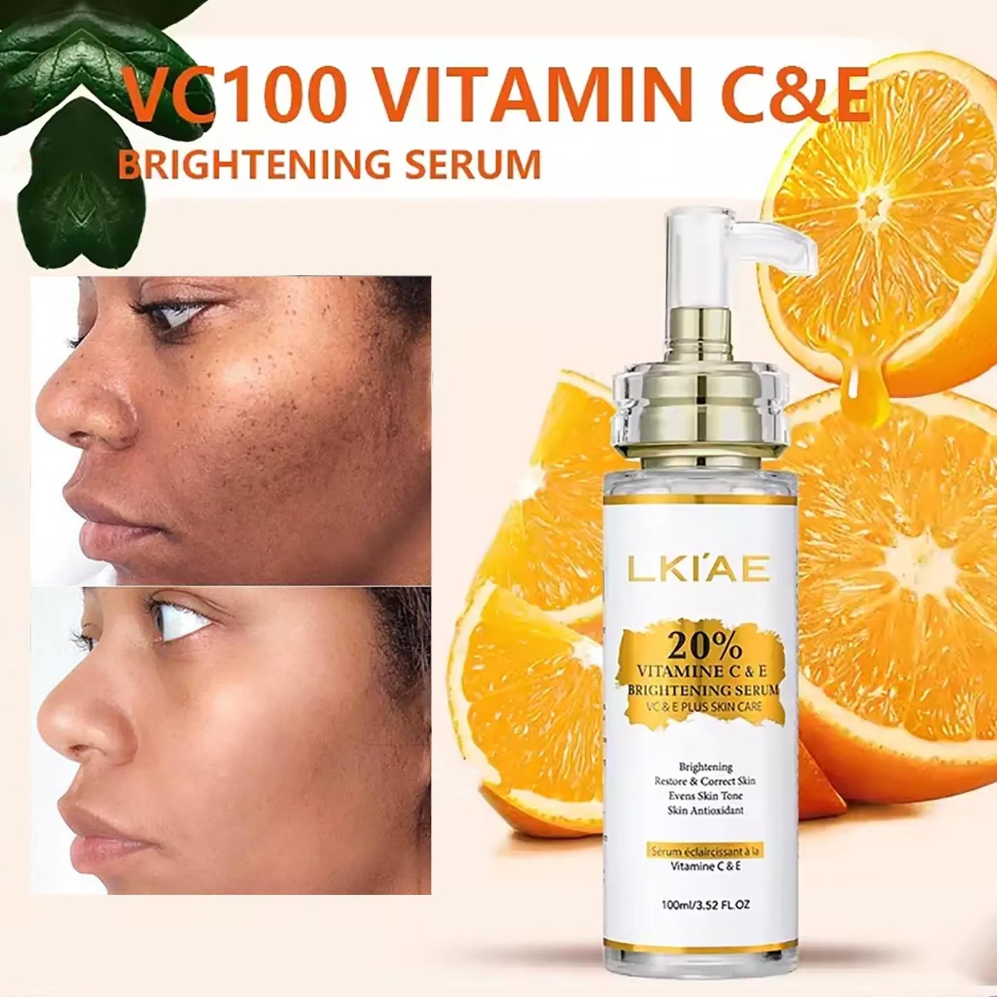 AILKE Vitamin C Skin Care Set With Brightening Body Lotion Even Skin Tone Face Cream Whitening Serum And Soap